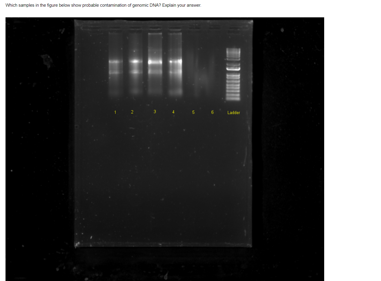 Solved Which samples in the figure below show probable | Chegg.com