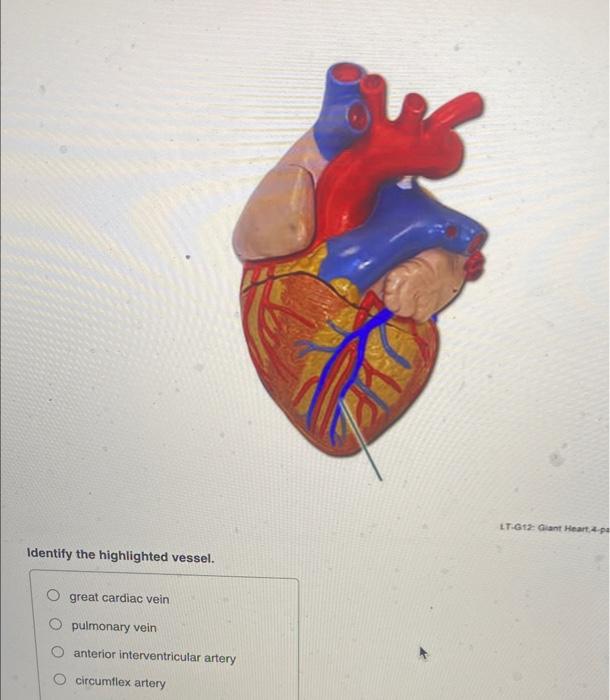 Solved Identify the highlighted vessel. great cardiac vein