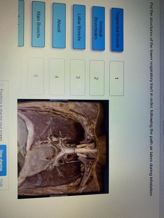 Solved Put the structures of the lower respiratory tract in | Chegg.com