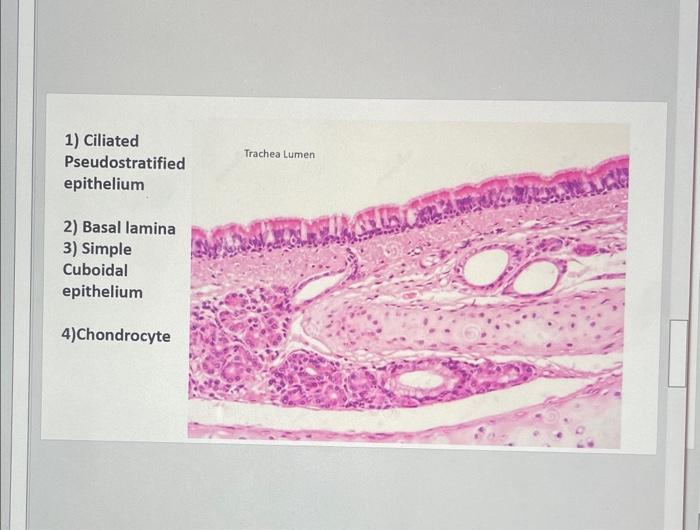 Solved 1) Ciliated Pseudostratified Trachea Lumen epithelium | Chegg.com