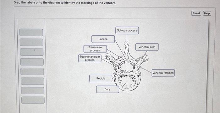 Drag the labels onto the diagram to identify the markings of the vertebra.
Lamina
????????
Transverse
process
Superior articu