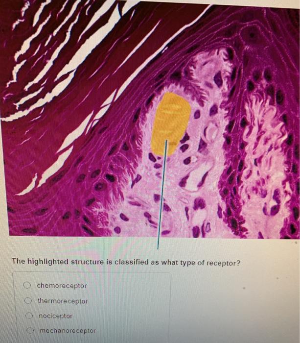 The highlighted structure is classified as what type of receptor? chemoreceptor thermoreceptor D nociceptor mechanoreceptor