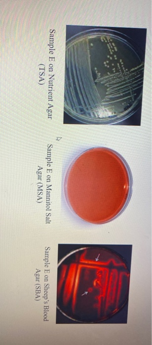 Solved Identifying Your Unknown Bacteria Step 1: Gram Stain | Chegg.com