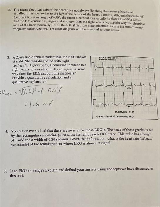 Tutorial: Electrocardiogram (EKG) Refer to the | Chegg.com