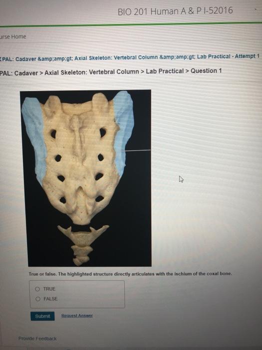 Solved Part A Identify The Highlighted Bone Submit Reque Chegg Com