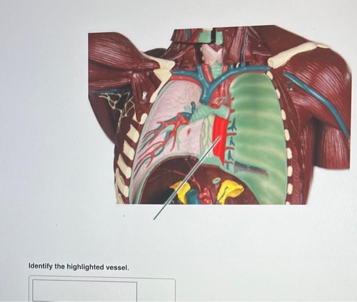 [Solved]: Identify the highlighted vessel.