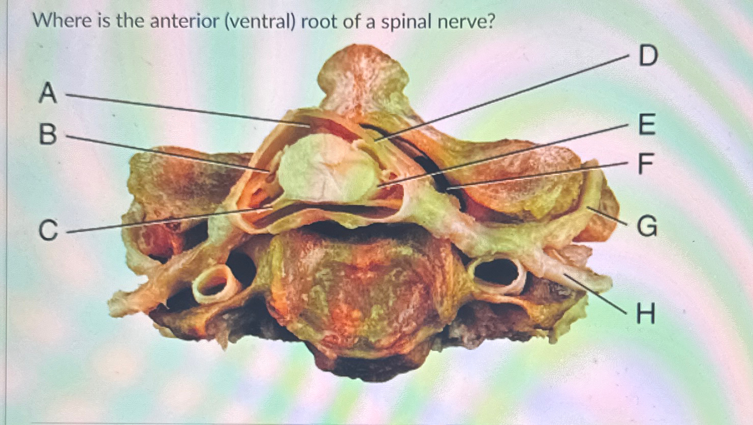 Solved Where is the anterior (ventral) ﻿root of a spinal | Chegg.com