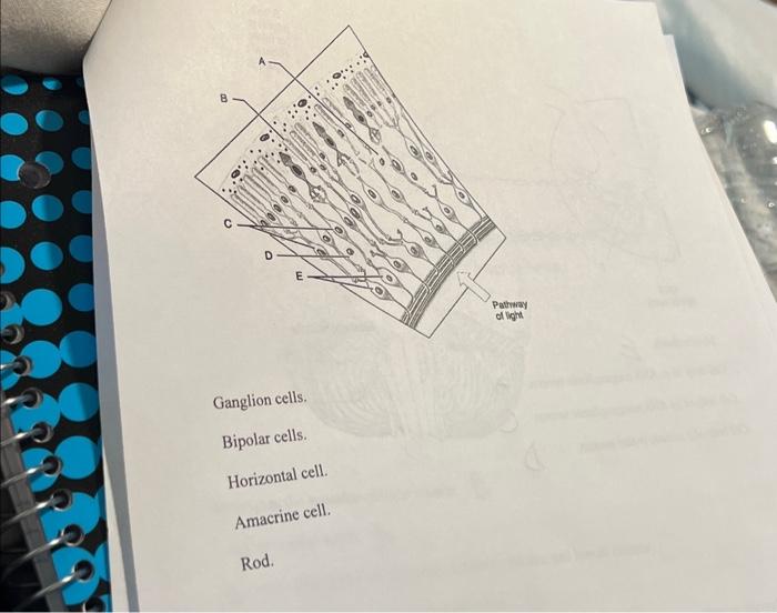 Ganglion cells. Bipolar cells. Horizontal cell. | Chegg.com