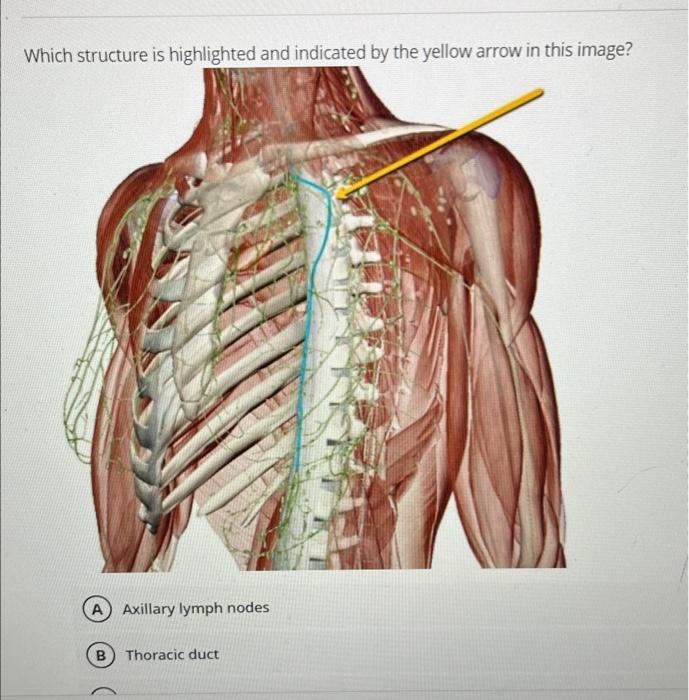 [Solved]: Which structure is highlighted and indicated by t