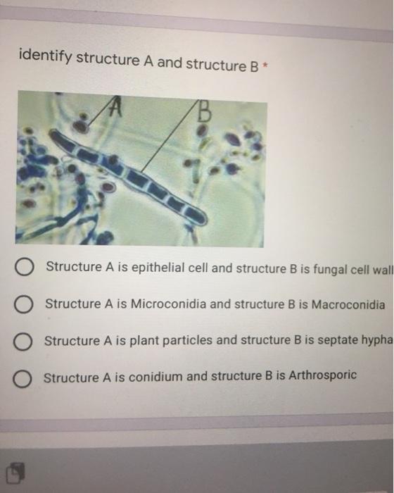 Solved identify structure A and structure B* Structure A is | Chegg.com
