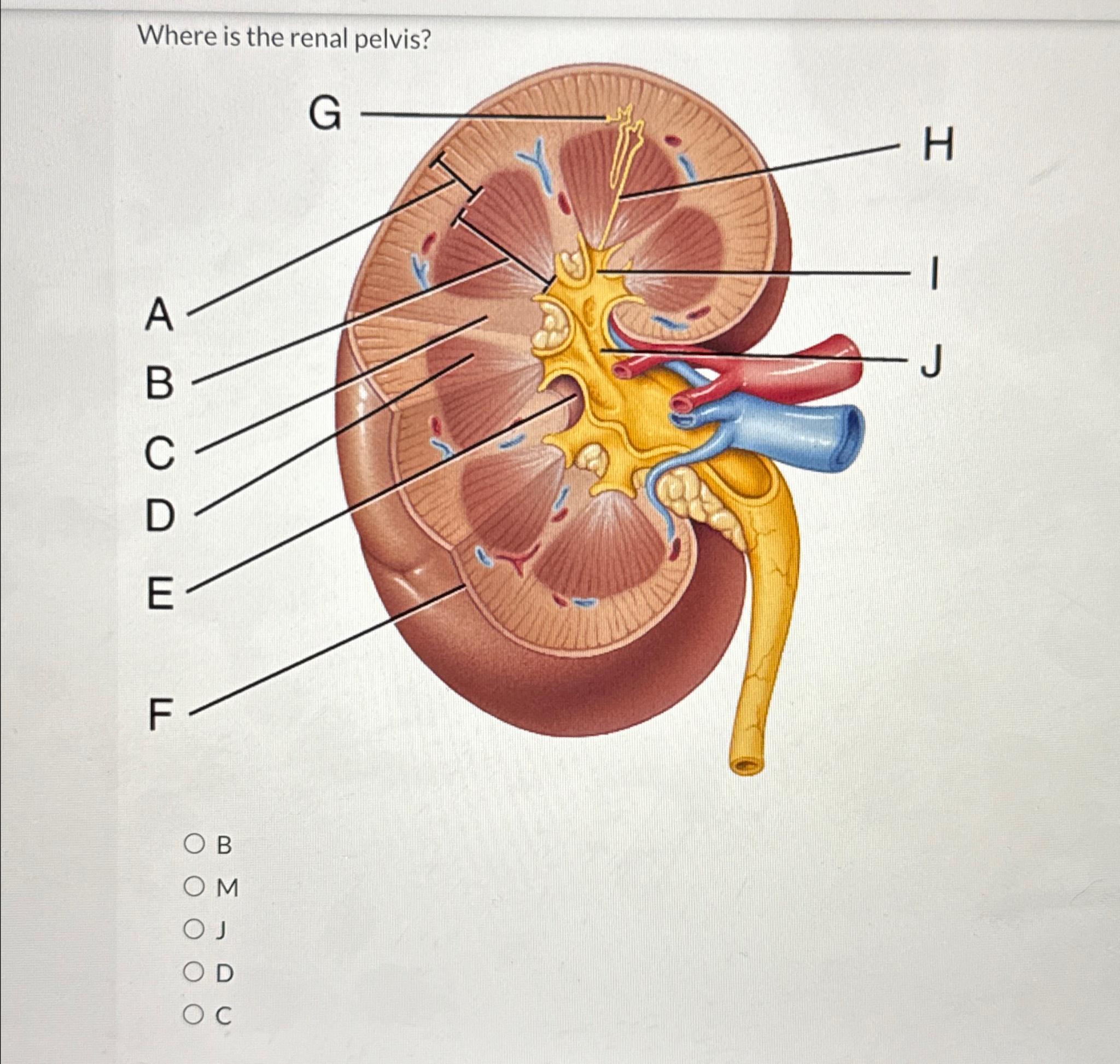 Solved Where is the renal pelvis?BMJDC | Chegg.com