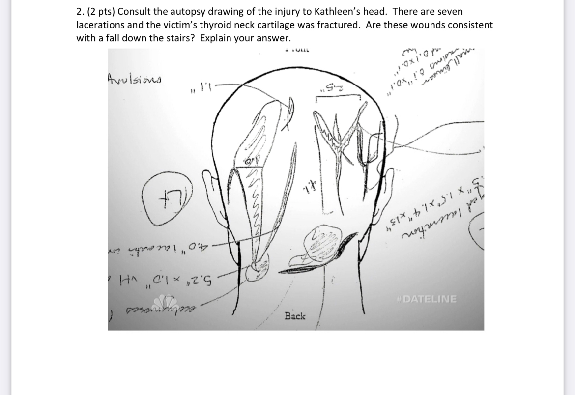 Solved (2 ﻿pts) ﻿Consult the autopsy drawing of the injury | Chegg.com