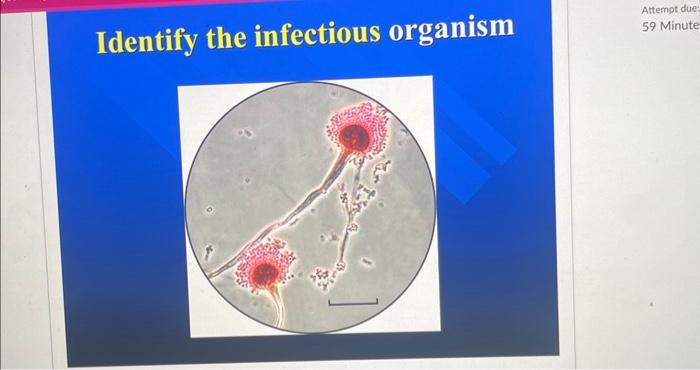 Solved Identify The Infectious Organism | Chegg.com