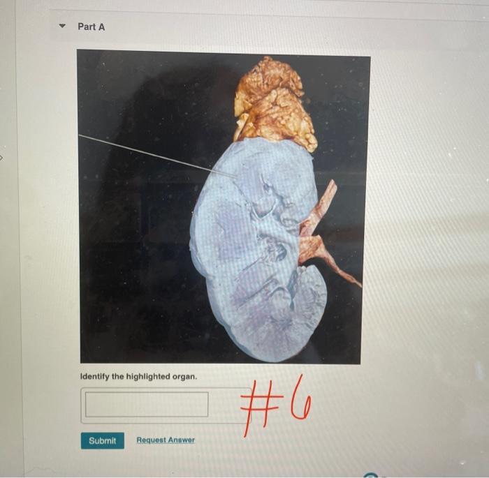 Solved Part A What enzyme hormone is released by the