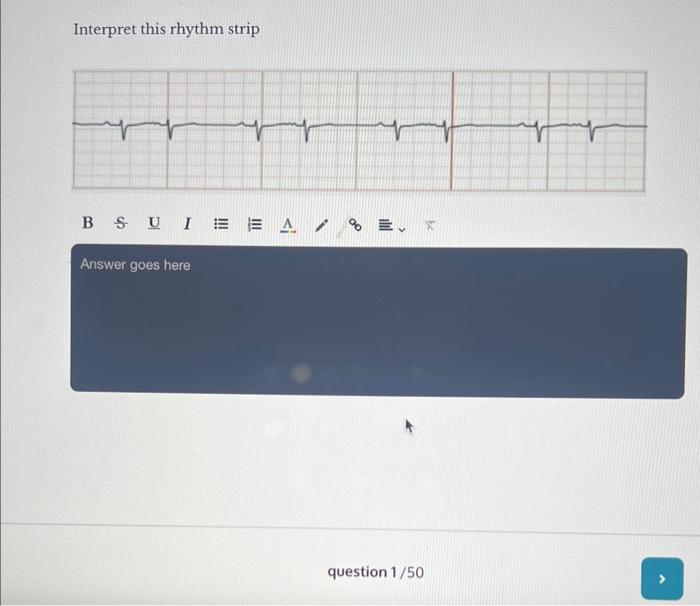 Interpret This Rhythm Strip Interpret This Rhythm | Chegg.com