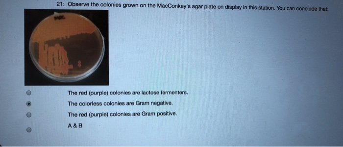 Colorless Colonies Solved 21: Observe the colonies grown on the MacConkey's | Chegg.com