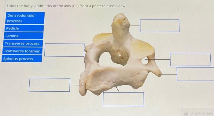 Solved Label the bones on the anterior and lateral views of | Chegg.com