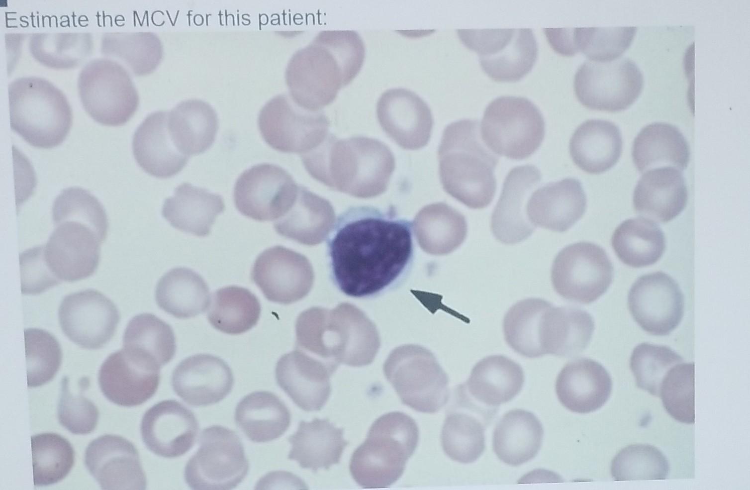 Solved Estimate the MCV for this patient: | Chegg.com