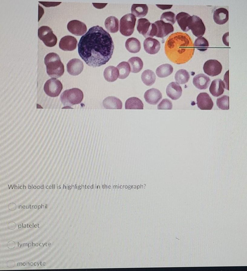 Solved Bill Wants To Determine His Blood Type So He Takes A Chegg