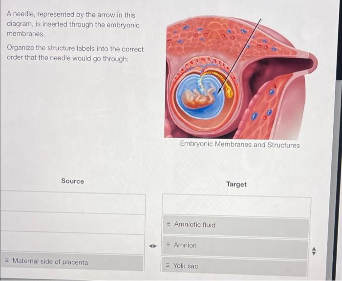 Solved A needle, represented by the arrow in this diagram,