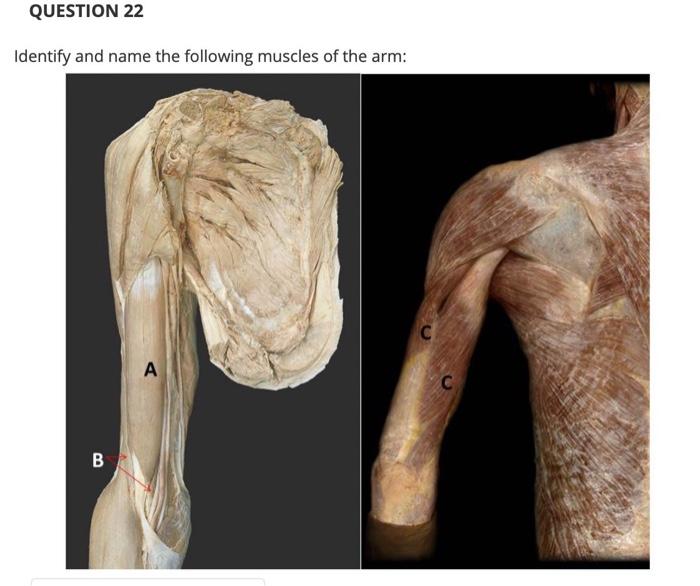 Solved Name the muscles from question 22 above that acts as