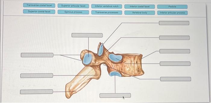 Solved Transverse costal facet Superior costal facet 11