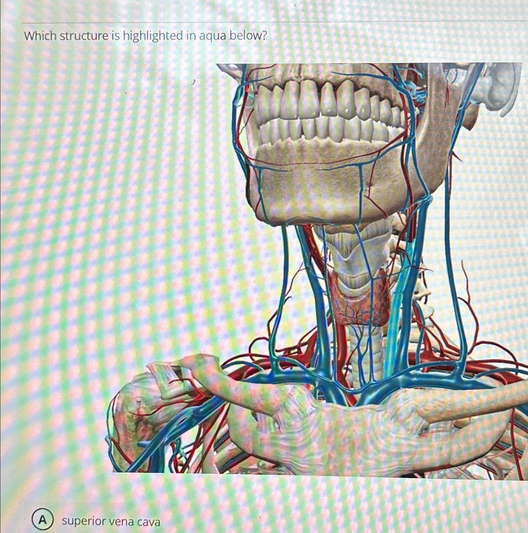 Solved Which structure is highlighted in aqua | Chegg.com