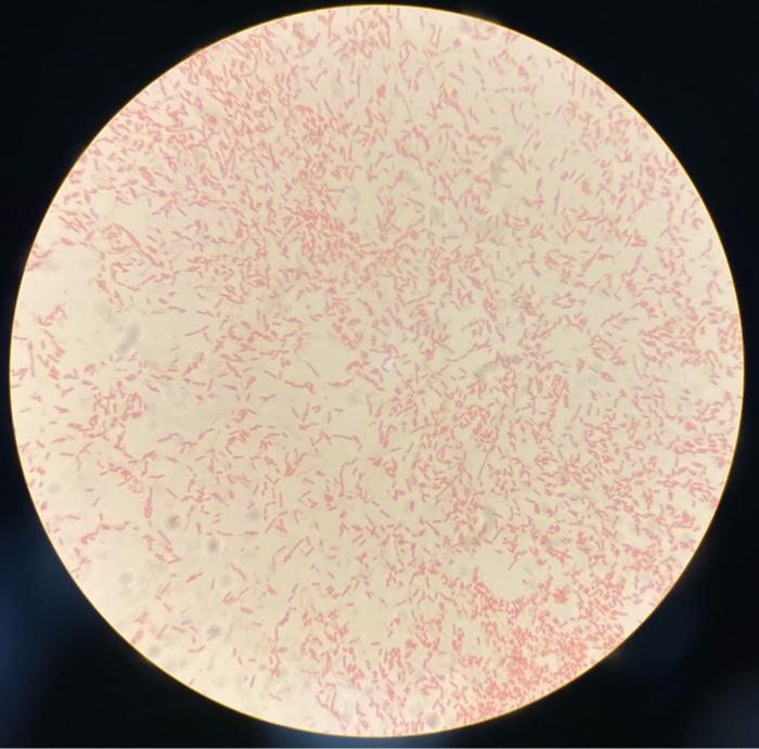 Ubiquity of Microorganisms ime fool and diritk. | Chegg.com