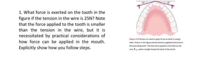 Solved 1. What force is exerted on the tooth in the figure | Chegg.com