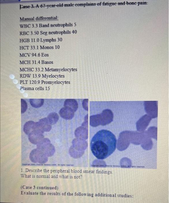 Solved Gase 3. A 67-year-old male cemplains of fatigue and | Chegg.com