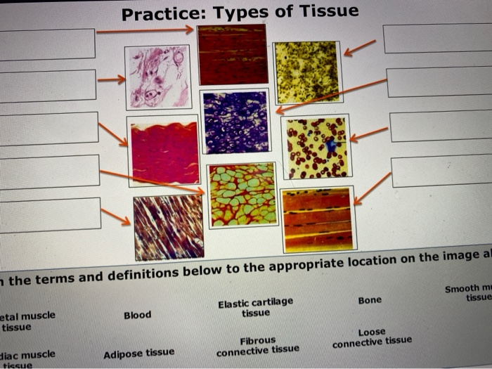 Solved Practice Types of Tissue the terms and definitions