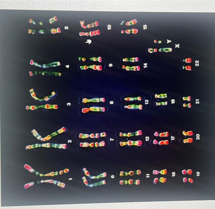 Solved Click On The Sex Chromosome Pair In The Karyotype Of