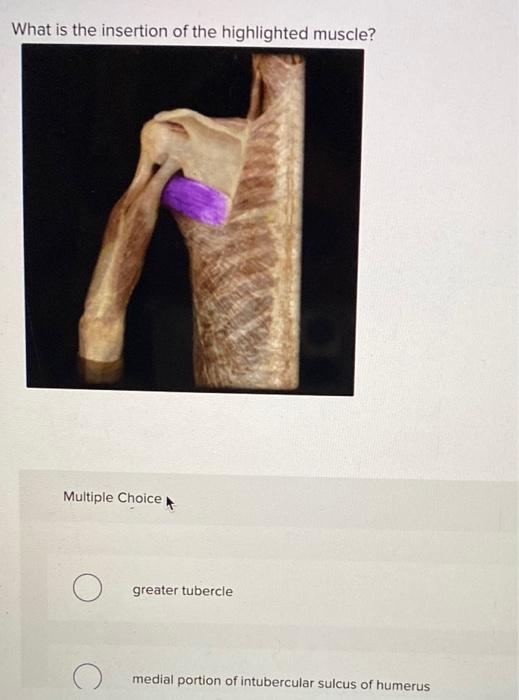 What is the insertion of the highlighted muscle?
Multiple Choice
greater tubercle
medial portion of intubercular sulcus of hu