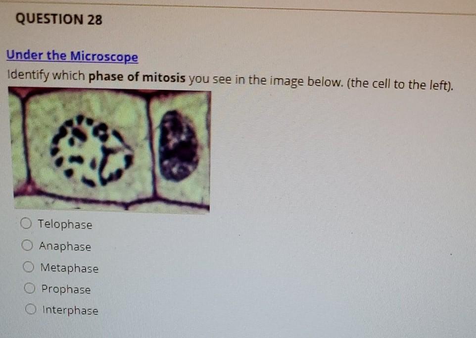 prophase under microscope