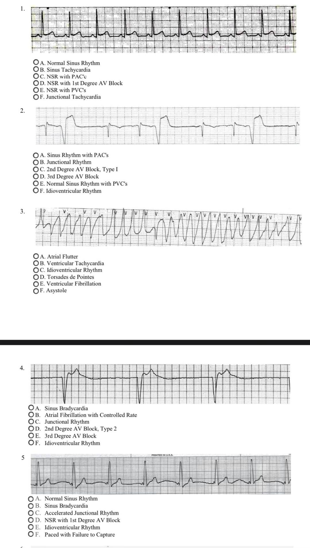 OA. Normal Sinus Rhythm OB. Sinus Tachycardia OC. NSR | Chegg.com