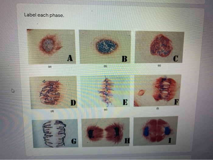 Solved the image below are of cells in mitosis that you 