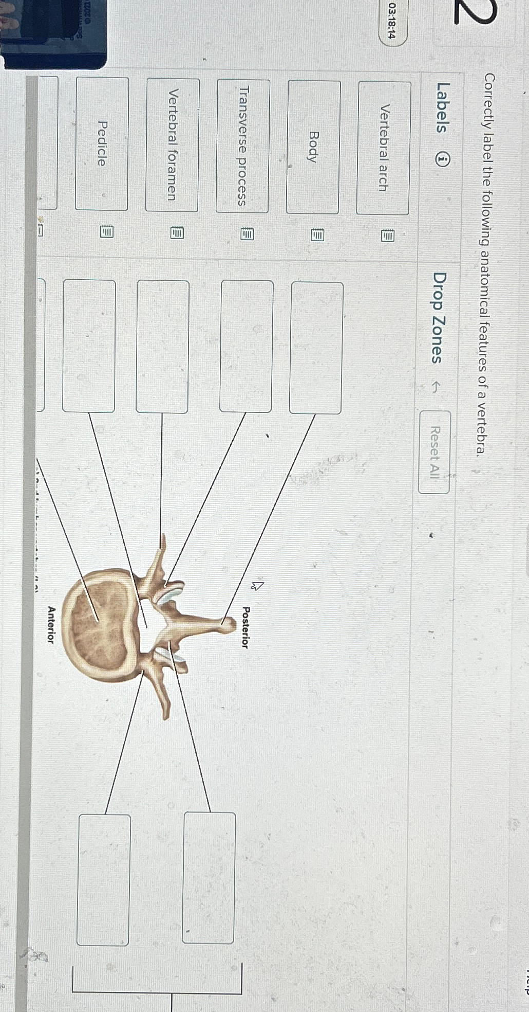 Solved Correctly label the following anatomical features of