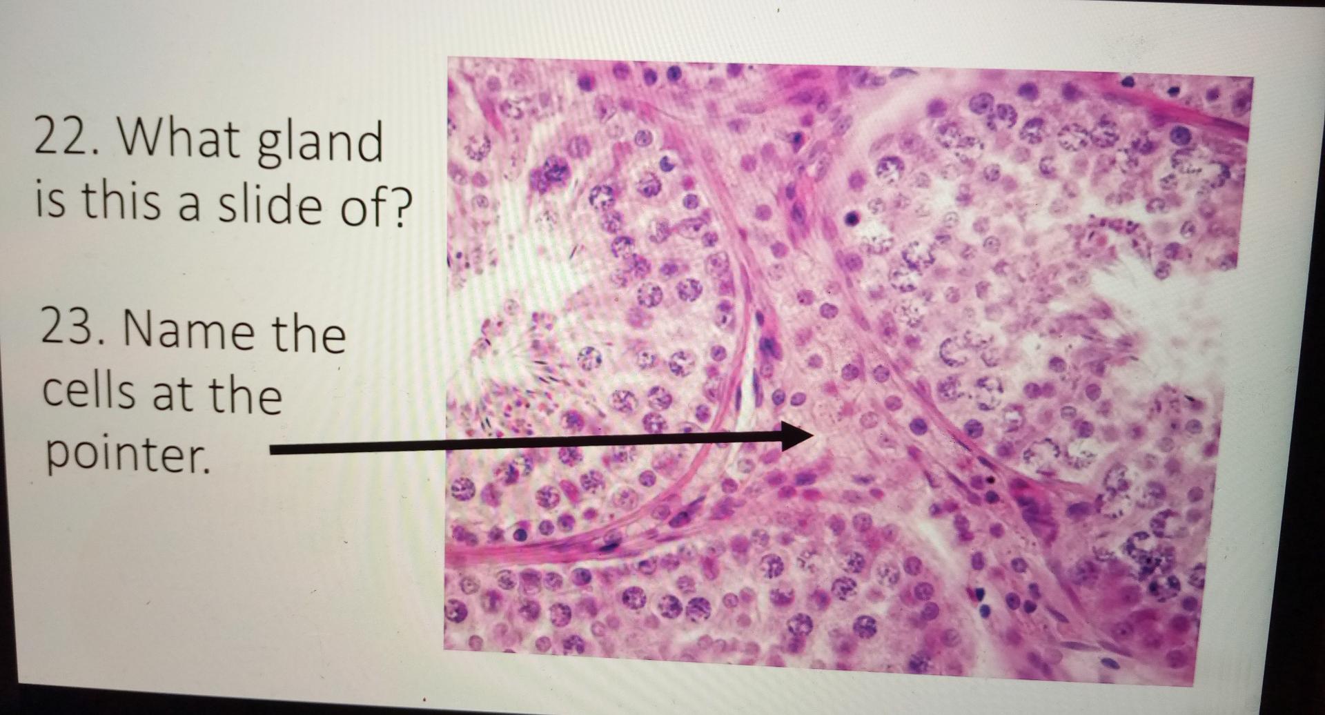 Solved 22. What Gland Is This A Slide Of? 23. Name The Cells 