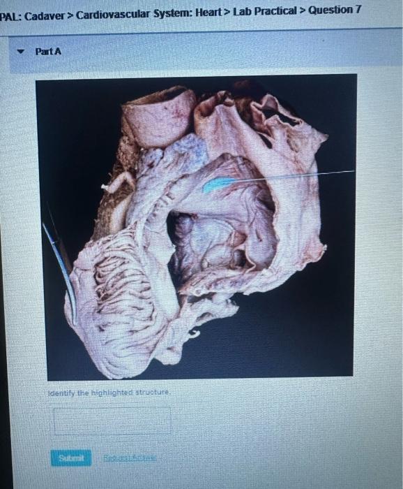 AL: Cadaver > Cardiovascular System: Heart> Lab Practical > Question 7
PartA
Helentity tre Aninghted strocotura: