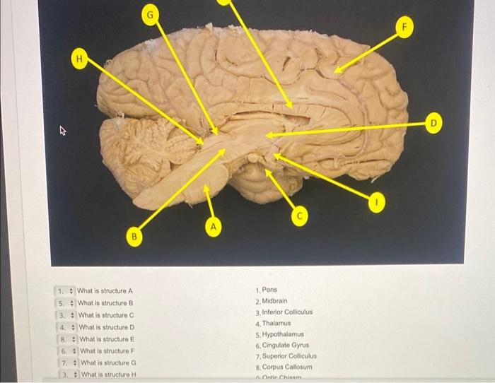 Solved What Is Structure A What Is Structure B What Is | Chegg.com