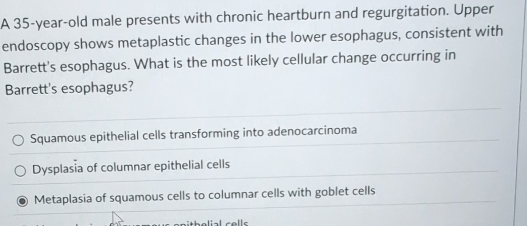 Solved A 35-year-old male presents with chronic heartburn | Chegg.com
