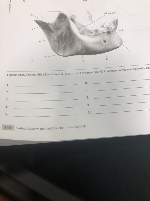 Solved - The left orbit, anterior view. (a) Structures of | Chegg.com