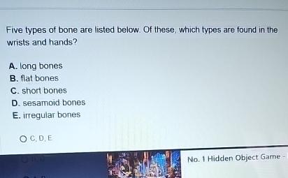 Solved Five Types Of Bone Are Listed Below. Of These, Which | Chegg.com