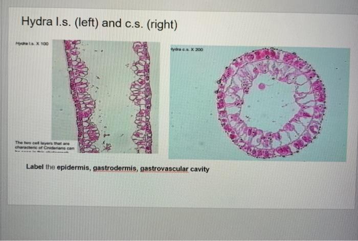 hydra cnidaria slide