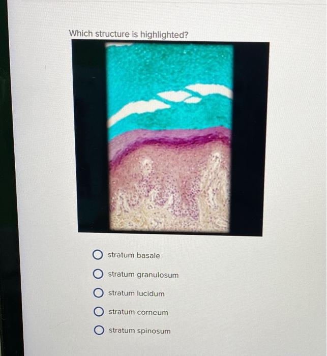 From Stratum Corneum To Stratum Basale Drag Learn - hv06iol