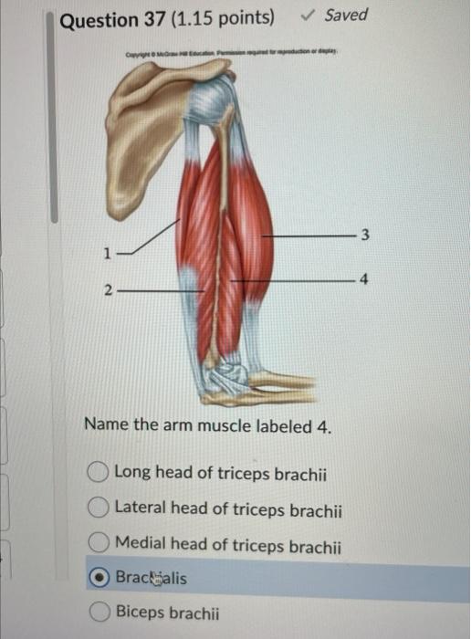 Solved Name the arm muscle labeled 4. Long head of triceps