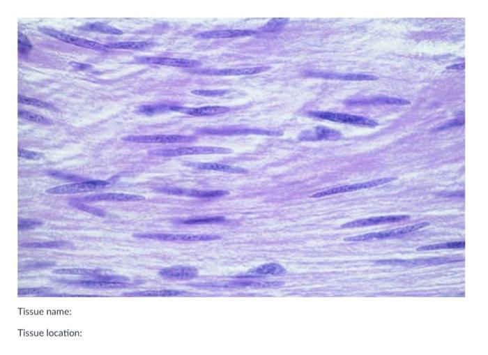 Solved Tissue Name: Tissue Location (only 1): Tissue | Chegg.com
