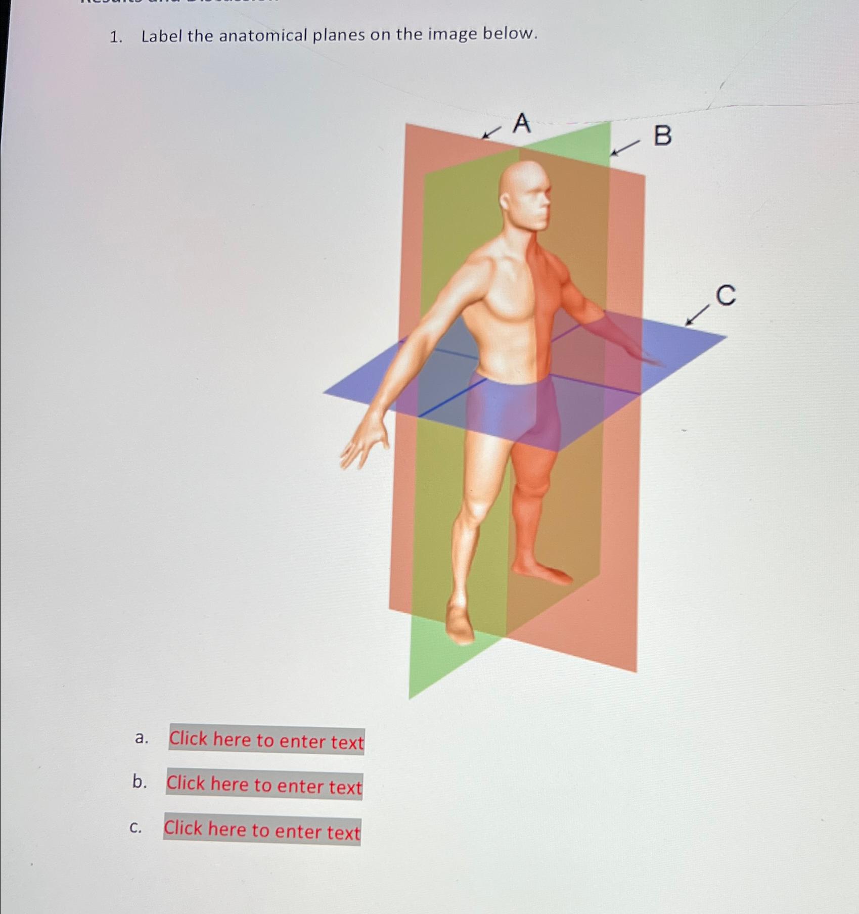 Solved Label the anatomical planes on the image below.a. | Chegg.com