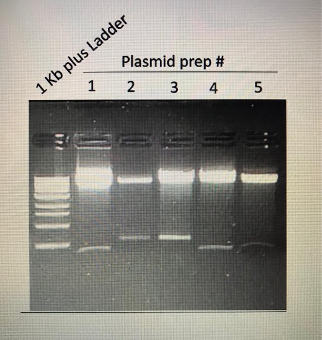 Solved Results: Number of DNA Ladder Size of DNA ladder in | Chegg.com