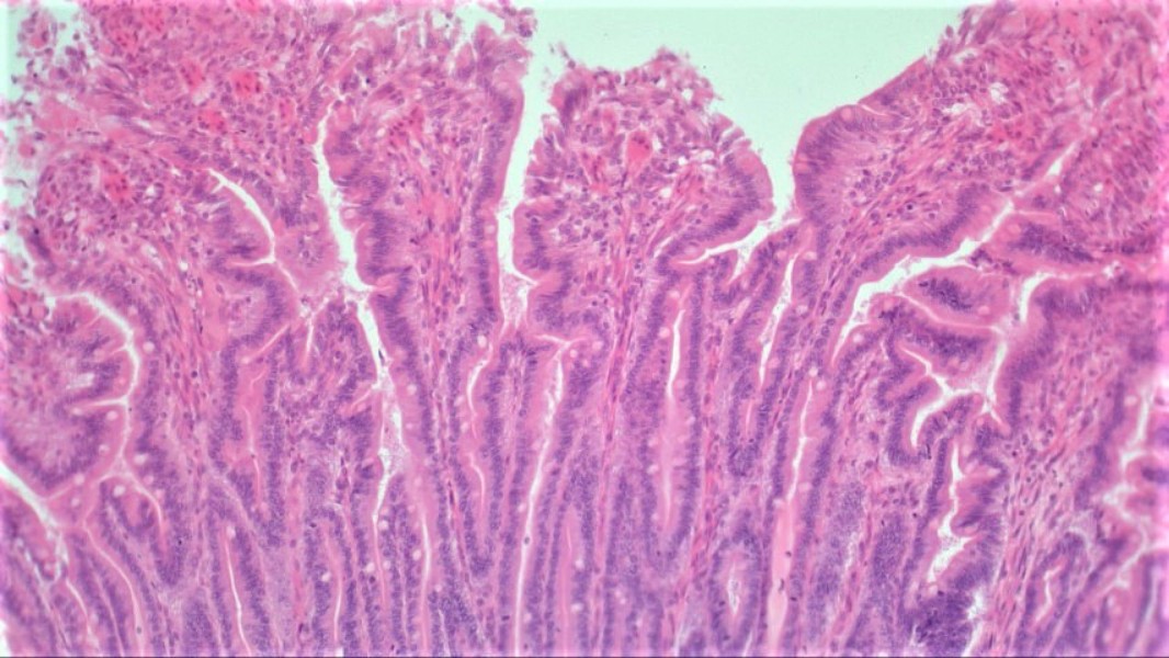 Solved Using the medium power Simple Columnar, Duodenum | Chegg.com